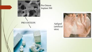 PRO OSTEON
Pro Osteon
Implant 500
Apligraf
(artificial
skin)
 