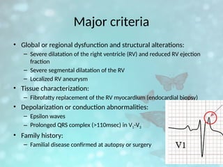 Major criteria
• Global or regional dysfunction and structural alterations:
– Severe dilatation of the right ventricle (RV) and reduced RV ejection
fraction
– Severe segmental dilatation of the RV
– Localized RV aneurysm
• Tissue characterization:
– Fibrofatty replacement of the RV myocardium (endocardial biopsy)
• Depolarization or conduction abnormalities:
– Epsilon waves
– Prolonged QRS complex (>110msec) in V1-V3
• Family history:
– Familial disease confirmed at autopsy or surgery
 