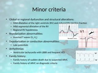 Minor criteria
• Global or regional dysfunction and structural alterations:
– Mild dilatation of the right ventricle (RV) and reduced RV ejection fraction
– Mild segmental dilatation of the RV
– Regional RV hypokinesia
• Repolarization abnormalities:
– Inverted T waves (V2-V3)
• Depolarization or conduction abnormalities:
– Late potentials
• Arrhythmias:
– Ventricular tachycardia with LBBB and frequent VES
• Family history:
– Family history of sudden death due to suspected ARVC
– Family history of ARVC on diagnostic criteria
 
