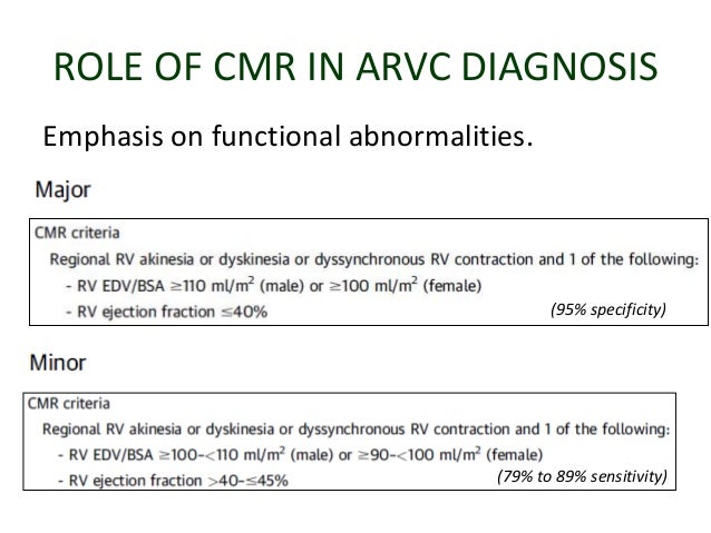 Arvc Criteria Mri _ Arrhythmogenic Right Ventricular Cardiomyopathy ...