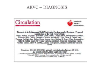 ARVC – DIAGNOSIS
“ARRYTHMOGENIC RIGHT
VENTRICULAR
CARDIOMYOPATHY”
 