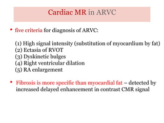 Cardiac MR in ARVC
“ARRYTHMOGENIC RIGHT
VENTRICULAR
CARDIOMYOPATHY”
• five criteria for diagnosis of ARVC:
(1) High signal intensity (substitution of myocardium by fat)
(2) Ectasia of RVOT
(3) Dyskinetic bulges
(4) Right ventricular dilation
(5) RA enlargement
• Fibrosis is more specific than myocardial fat – detected by
increased delayed enhancement in contrast CMR signal
 