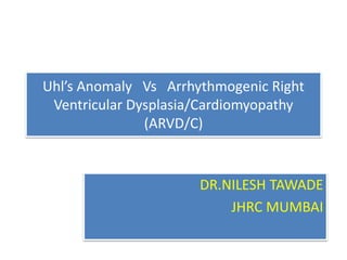 Uhl’s Anomaly Vs Arrhythmogenic Right
Ventricular Dysplasia/Cardiomyopathy
(ARVD/C)
DR.NILESH TAWADE
JHRC MUMBAI
 