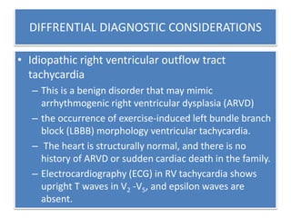DIFFRENTIAL DIAGNOSTIC CONSIDERATIONS
• Idiopathic right ventricular outflow tract
tachycardia
– This is a benign disorder that may mimic
arrhythmogenic right ventricular dysplasia (ARVD)
– the occurrence of exercise-induced left bundle branch
block (LBBB) morphology ventricular tachycardia.
– The heart is structurally normal, and there is no
history of ARVD or sudden cardiac death in the family.
– Electrocardiography (ECG) in RV tachycardia shows
upright T waves in V2 -V5, and epsilon waves are
absent.
 