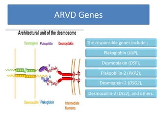 ARVD Genes
The responsible genes include :
Plakoglobin (JUP),
Desmoplakin (DSP),
Plakophilin-2 (PKP2),
Desmoglein-2 (DSG2),
Desmocollin-2 (Dsc2), and others.
 