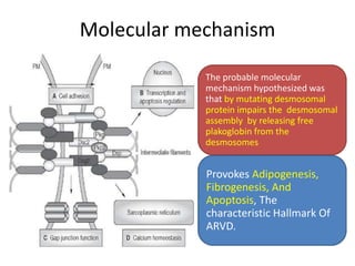 Molecular mechanism
The probable molecular
mechanism hypothesized was
that by mutating desmosomal
protein impairs the desmosomal
assembly by releasing free
plakoglobin from the
desmosomes
Provokes Adipogenesis,
Fibrogenesis, And
Apoptosis, The
characteristic Hallmark Of
ARVD.
 