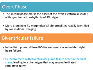 Overt Phase
• The second phase marks the onset of the overt electrical disorder,
with symptomatic arrhythmia of RV origin
• More prominent RV morphological abnormalities readily identified
by conventional imaging .
Biventricular failure
• In the third phase, diffuse RV disease results in an isolated right
heart failure.
• LV involvement with biventricular pump failure occur in the final
stage, leading to a phenotype that may resemble dilated
cardiomyopathy
 