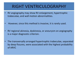 • RV angiography may show RV enlargement, hypertrophic
trabeculae, and wall motion abnormalities.
• However, since this method is invasive, it is rarely used.
• RV regional akinesia, dyskinesia, or aneurysm on angiography
is a major diagnostic criterion.
• The transversally arranged hypertrophic trabeculae, separated
by deep fissures, were associated with the highest probability
of ARVC
RIGHT VENTRICULOGRAPHY
 