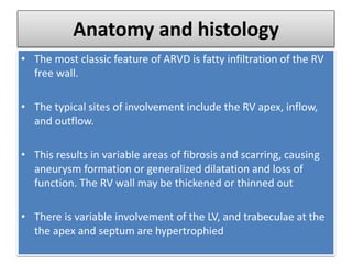 Anatomy and histology
• The most classic feature of ARVD is fatty infiltration of the RV
free wall.
• The typical sites of involvement include the RV apex, inflow,
and outflow.
• This results in variable areas of fibrosis and scarring, causing
aneurysm formation or generalized dilatation and loss of
function. The RV wall may be thickened or thinned out
• There is variable involvement of the LV, and trabeculae at the
the apex and septum are hypertrophied
 