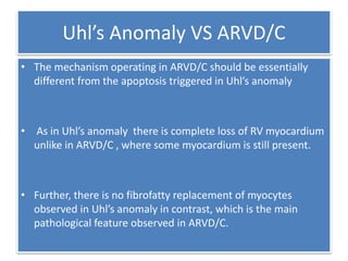 Uhl’s Anomaly VS ARVD/C
• The mechanism operating in ARVD/C should be essentially
different from the apoptosis triggered in Uhl’s anomaly
• As in Uhl’s anomaly there is complete loss of RV myocardium
unlike in ARVD/C , where some myocardium is still present.
• Further, there is no fibrofatty replacement of myocytes
observed in Uhl’s anomaly in contrast, which is the main
pathological feature observed in ARVD/C.
 