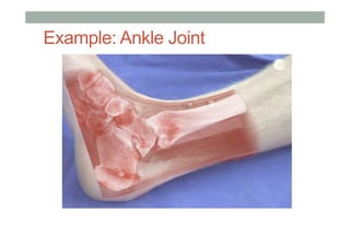 Example: Ankle Joint
 