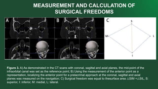 Axial Approach ARYA-1.pptx