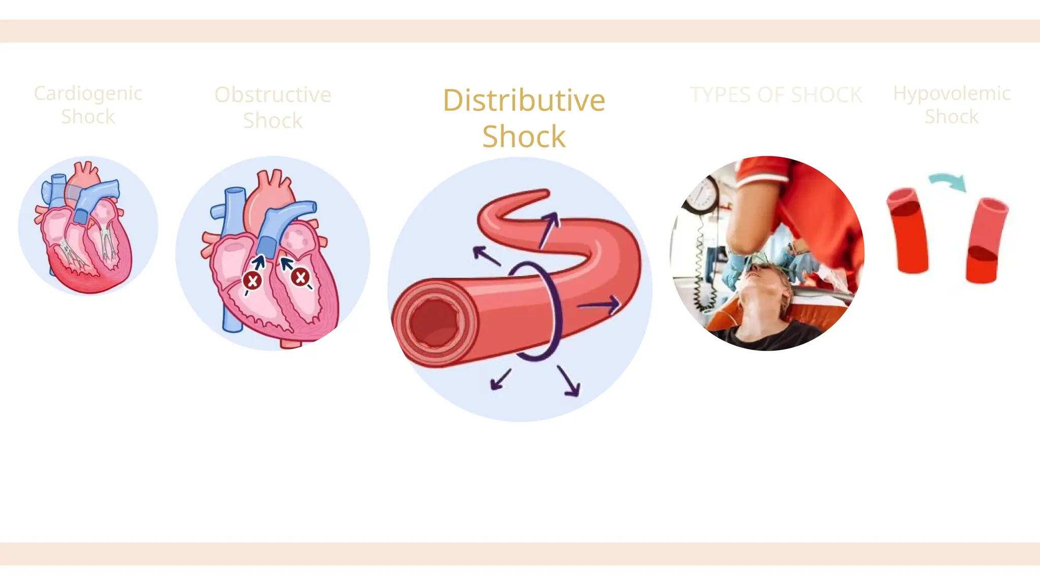 PATHOPHYSIOLOGY AND TYPES OF SHOCK - MBBS.pptx
