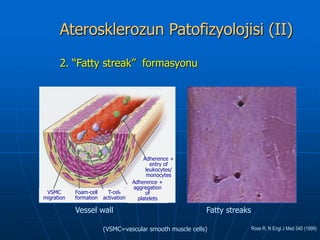 Aterosklerozun Patofizyolojisi (II)
      2. “Fatty streak” formasyonu




                                          Adherence +
                                             entry of
                                           leukocytes/
                                            monocytes
                                     Adherence +
                                     aggregation
 VSMC       Foam-cell     T-cell           of
migration   formation   activation     platelets

            Vessel wall                                   Fatty streaks

                        (VSMC=vascular smooth muscle cells)               Ross R, N Engl J Med 340 (1999)
 