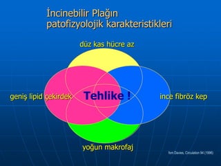 İncinebilir Plağın
           patofizyolojik karakteristikleri
                       düz kas hücre az




geniş lipid çekirdek    Tehlike !         ince fibröz kep




                       yoğun makrofaj
                                            fom Davies, Circulation 94 (1996)
 