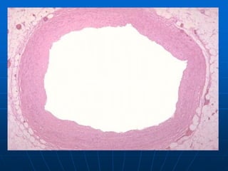 Normal koroner damar kesiti
 