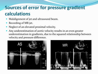 Sources of error for pressure gradient
calculations
 Malalignment of jet and ultrasound beam.
 Recording of MR jet.
 Neglect of an elevated proximal velocity.
 Any underestimation of aortic velocity results in an even greater
underestimation in gradients, due to the squared relationship between
velocity and pressure difference.
 