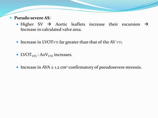  Pseudo severe AS:
 Higher SV  Aortic leaflets increase their excursion 
Increase in calculated valve area.
 Increase in LVOTVTI far greater than that of the AV VTI.
 LVOTVTI : AoVVTI increases.
 Increase in AVA ≥ 1.2 cm2 confirmatory of pseudosevere stenosis.
 