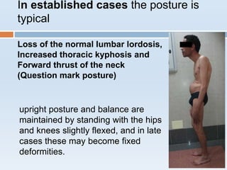 In established cases the posture is
typical
Loss of the normal lumbar lordosis,
Increased thoracic kyphosis and
Forward thrust of the neck
(Question mark posture)
upright posture and balance are
maintained by standing with the hips
and knees slightly flexed, and in late
cases these may become fixed
deformities.
 