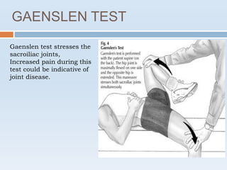 GAENSLEN TEST
Gaenslen test stresses the
sacroiliac joints,
Increased pain during this
test could be indicative of
joint disease.
 
