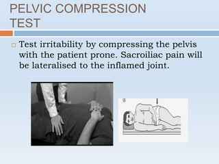  Test irritability by compressing the pelvis
with the patient prone. Sacroiliac pain will
be lateralised to the inflamed joint.
PELVIC COMPRESSION
TEST
 