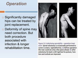 Operation
 Significantly damaged
hips can be treated by
joint replacement.
 Deformity of spine may
need correction. But
both procedure
associated with
infection & longer
rehabilitation time.
 