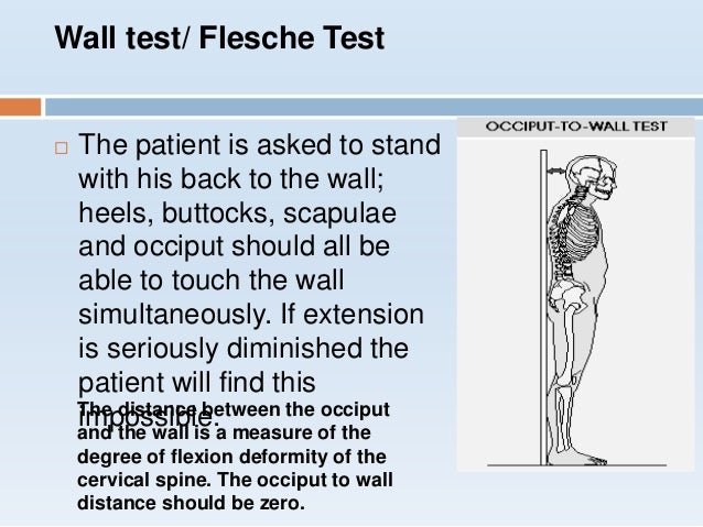 Occiput To Wall Distance Test