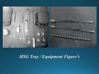 PERCITANEOUS NEPHROSTOMY and HYSTEROSALPIONGOGRAPHY | PPTX