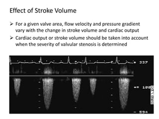 Effect of Stroke Volume
 For a given valve area, flow velocity and pressure gradient
vary with the change in stroke volume and cardiac output
 Cardiac output or stroke volume should be taken into account
when the severity of valvular stenosis is determined
 