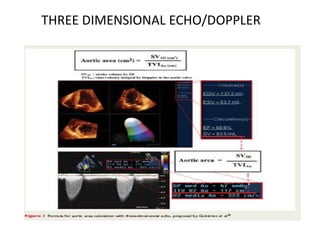 THREE DIMENSIONAL ECHO/DOPPLER
 