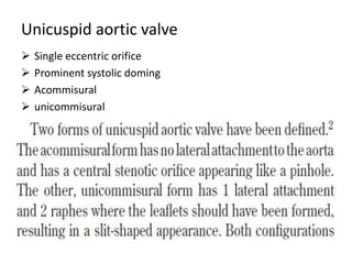 Unicuspid aortic valve
 Single eccentric orifice
 Prominent systolic doming
 Acommisural
 unicommisural
 