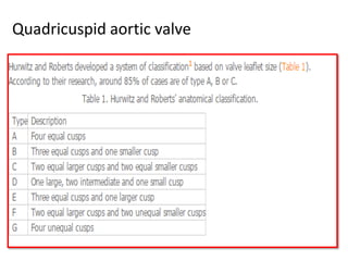 Quadricuspid aortic valve
 