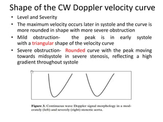 Shape of the CW Doppler velocity curve
• Level and Severity
• The maximum velocity occurs later in systole and the curve is
more rounded in shape with more severe obstruction
• Mild obstruction- the peak is in early systole
with a triangular shape of the velocity curve
• Severe obstruction- Rounded curve with the peak moving
towards midsystole in severe stenosis, reflecting a high
gradient throughout systole
 