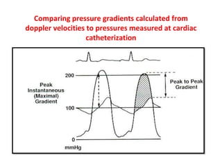 Comparing pressure gradients calculated from
doppler velocities to pressures measured at cardiac
catheterization
 