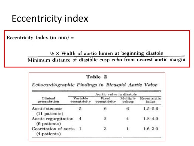 Aortic stenosis Echo
