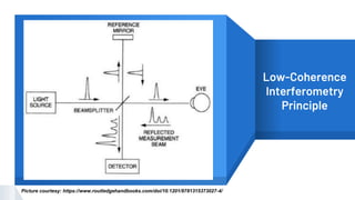 “ Low-Coherence
Interferometry
Principle
Picture courtesy: https://www.routledgehandbooks.com/doi/10.1201/9781315373027-4/
 