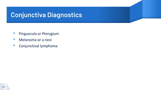 Conjunctiva Diagnostics
▸ Pinguecula or Pterygium
▸ Melanoma or a nevi
▸ Conjunctival lymphoma
46
 
