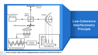“
5
Low-Coherence
Interferometry
Principle
Picture courtesy: https://www.routledgehandbooks.com/doi/10.1201/9781315373027-4/
 