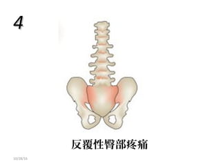 10/28/16
反覆性臀部疼痛
44
 