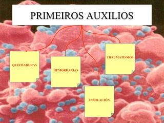 PRIMEIROS AUXILIOSPRIMEIROS AUXILIOS
QUEIMADURAS
TRAUMATISMOS
INSOLACIÓN
HEMORRAXIAS
 