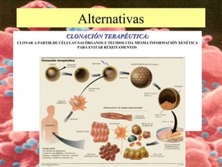 Alternativas
CLONACIÓN TERAPÉUTICA:CLONACIÓN TERAPÉUTICA:
CLONAR A PARTIR DE CÉLULAS NAI ÓRGANOS E TECIDOS COA MESMA INFORMACIÓN XENÉTICA
PARA EVITAR REXEITAMENTOS
 
