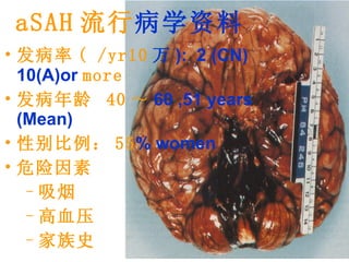 aSAH 流行 病学资料 发病率 ( /yr10 万 ):  2 (CN) 10(A)or   more   发病年龄  40 ～ 60 ,51 years (Mean) 性别比例： 55 % women 危险因素 吸烟 高血压 家族史 