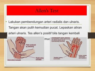 Allen’s Test
• Lakukan pembendungan arteri radialis dan ulnaris.
Tangan akan putih kemudian pucat. Lepaskan aliran
arteri ulnaris. Tes allen’s positif bila tangan kembali
menjadi berwarna merah muda.
 