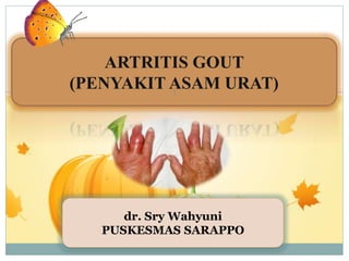 ARTRITIS GOUT
(PENYAKIT ASAM URAT)
dr. Sry Wahyuni
PUSKESMAS SARAPPO
1
 