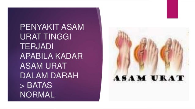 Asam Urat In English