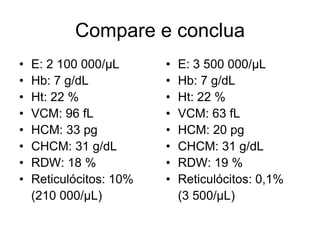 Compare e conclua
•   E: 2 100 000/µL      •   E: 3 500 000/µL
•   Hb: 7 g/dL           •   Hb: 7 g/dL
•   Ht: 22 %             •   Ht: 22 %
•   VCM: 96 fL           •   VCM: 63 fL
•   HCM: 33 pg           •   HCM: 20 pg
•   CHCM: 31 g/dL        •   CHCM: 31 g/dL
•   RDW: 18 %            •   RDW: 19 %
•   Reticulócitos: 10%   •   Reticulócitos: 0,1%
    (210 000/µL)             (3 500/µL)
 