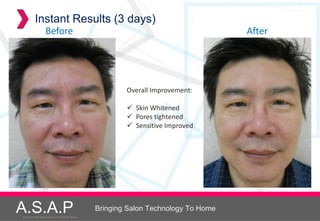 Instant Results (3 days)
                    Before                                                                After




                                                              Overall Improvement:

                                                               Skin Whitened
                                                               Pores tightened
                                                               Sensitive Improved




A.S.A.P
Accelerated Skin Augmentation and Perfection System
                                                      Bringing Salon Technology To Home
 