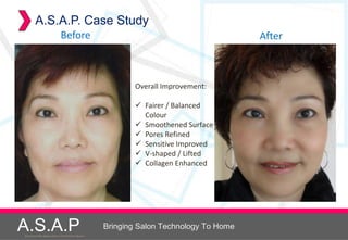 A.S.A.P. Case Study
                              Before                                                      After



                                                             Overall Improvement:

                                                              Fairer / Balanced
                                                               Colour
                                                              Smoothened Surface
                                                              Pores Refined
                                                              Sensitive Improved
                                                              V-shaped / Lifted
                                                              Collagen Enhanced




A.S.A.P
Accelerated Skin Augmentation and Perfection System
                                                      Bringing Salon Technology To Home
 