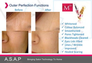 Outer Perfection Functions
                          Before                                      After



                                                                                       Whitened
                                                                                       Colour Balanced
                                                                                       Smoothened
                                                                                       Pores Tightened
                                                                                       Blackheads Cleared
                                                                                       Eyes Lids lifted
                                                                                       Lines / Wrinkle
                                                                                        improved
                                                                                       Healed Scaring

A.S.A.P
Accelerated Skin Augmentation and Perfection System
                                                      Bringing Salon Technology To Home
 