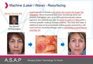 Machine (Laser / Wave) - Resurfacing
                                                         A general rule of thumb is the better the results the longer the
Michael Tomcik, MD
                                                         downtime. Micro fractional CO2 laser resurfacing alone can
                                                         smooth and tighten skin up to 60% and dramatically reduce
                                                         pigment. Our patients are able to return to work in 7 days with a
                                                         minimal powder makeup to cover redness. The neck area takes 2
                                                         additional days to be presentable and is usually covered by a silk
       San Ramon
                                                         scarf and the chest/decellotage area is covered by a closed blouse
      Dermatologist
                                                         until day 14…




A.S.A.P
  Accelerated Skin Augmentation and Perfection System
                                                        Bringing Salon Technology To Home
 
